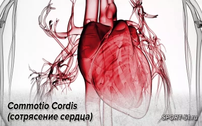Commotio Cordis (сотрясение сердца)