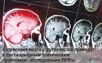 Сотрясения мозга у футболистов приводят к пост-карьерным психическим проблемам - исследования FIFPro